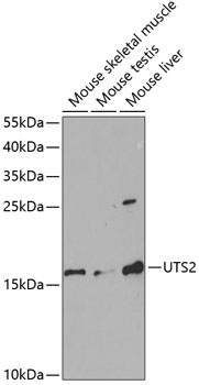 Western blot - UTS2 Polyclonal Antibody 