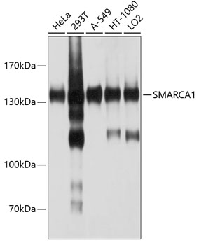 Western blot - SMARCA1 Polyclonal Antibody 