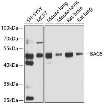 Western blot - BAG5 Polyclonal Antibody 