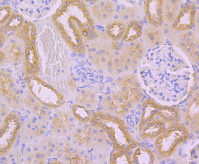 Fig2: Immunohistochemical analysis of paraffin-embedded rat kidney tissue using anti-TMEM2 antibody. Counter stained with hematoxylin.
