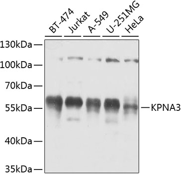 Western blot - KPNA3 Polyclonal Antibody 