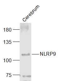 Fig1: Sample:; Cerebrum (Mouse) Lysate at 40 ug; Primary: Anti-NLRP9 at 1/1000 dilution; Secondary: IRDye800CW Goat Anti-Rabbit IgG at 1/20000 dilution; Predicted band size: 109 kD; Observed band size: 109 kD