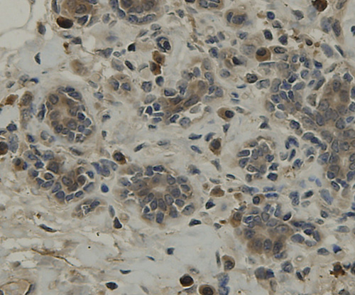 Fig6: Immunohistochemical analysis of paraffin-embedded human breast tissue using anti-TMEM177 antibody. Counter stained with hematoxylin.