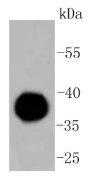 Fig1:; Western blot analysis of IgG4 on human plasma lysates. Proteins were transferred to a PVDF membrane and blocked with 5% BSA in PBS for 1 hour at room temperature. The primary antibody ( 1/500) was used in 5% BSA at room temperature for 2 hours. Goat Anti-Rabbit IgG - HRP Secondary Antibody (HA1001) at 1:5,000 dilution was used for 1 hour at room temperature.
