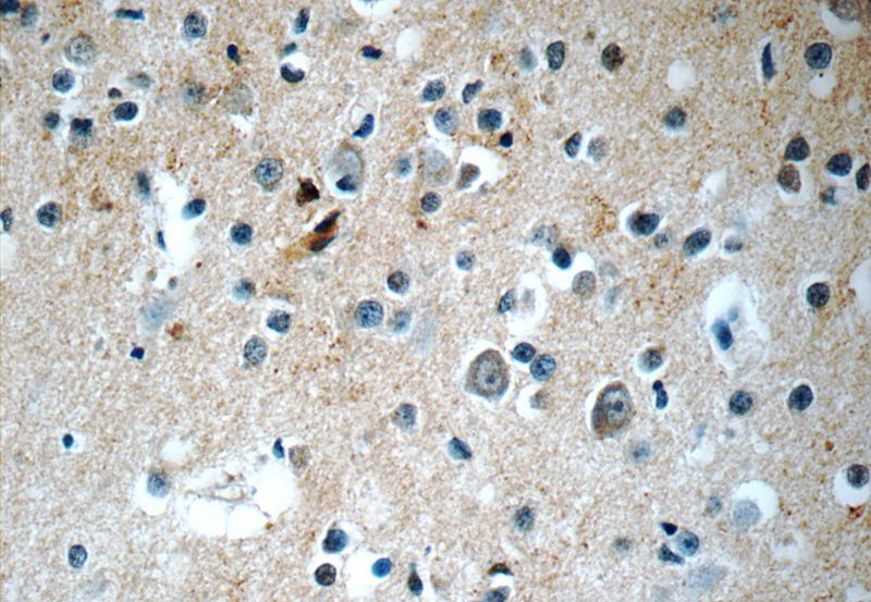 Immunohistochemistry of paraffin-embedded human brain tissue slide using Catalog No:115472(SNX17 Antibody) at dilution of 1:50 (under 40x lens)
