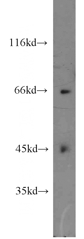 HeLa cells were subjected to SDS PAGE followed by western blot with Catalog No:110664(FIGNL1 antibody) at dilution of 1:1500