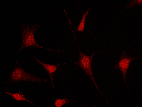 Musashi-1 Antibody, Rabbit PAb, Antigen Affinity Purified, Immunofluorescence