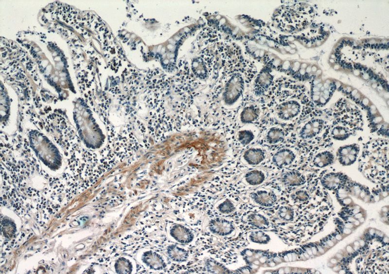 Immunohistochemistry of paraffin-embedded human small intestine tissue slide using Catalog No:112604(MGP Antibody) at dilution of 1:50 (under 10x lens)