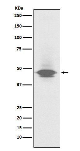 Western blot analysis of CD79a expression in human spleen lysate.