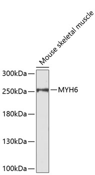 Western blot - MYH6 Polyclonal Antibody 