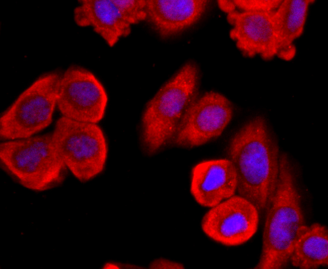 Fig3:; ICC staining of MUC2 in HepG2 cells (red). Formalin fixed cells were permeabilized with 0.1% Triton X-100 in TBS for 10 minutes at room temperature and blocked with 10% negative goat serum for 15 minutes at room temperature. Cells were probed with the primary antibody ( 1/50) for 1 hour at room temperature, washed with PBS. Alexa Fluor®594 conjugate-Goat anti-Rabbit IgG was used as the secondary antibody at 1/1,000 dilution. The nuclear counter stain is DAPI (blue).