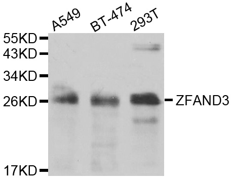 Western blot - ZFAND3 Polyclonal Antibody 
