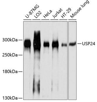 Western blot - USP24 Polyclonal Antibody 