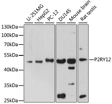 Western blot - P2RY12 Polyclonal Antibody 