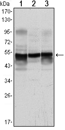 Western blot analysis using GFAP mouse mAb against A431 (1), SK-N-SH (2) and PC12 (3) cell lysate.