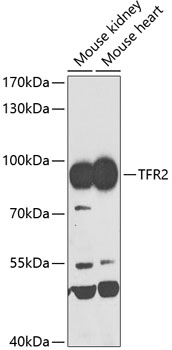 Western blot - TFR2 Polyclonal Antibody 