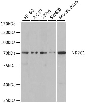 Western blot - NR2C1 Polyclonal Antibody 