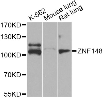 Western blot - ZNF148 Polyclonal Antibody 