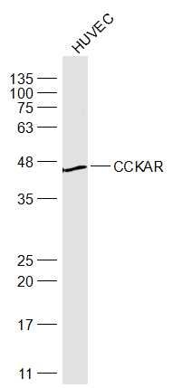 Fig2: Sample:; HUVEC(Human) Cell Lysate at 30 ug; Primary: Anti-CCKAR at 1/1000 dilution; Secondary: IRDye800CW Goat Anti-Rabbit IgG at 1/20000 dilution; Predicted band size: 48 kD; Observed band size: 48 kD