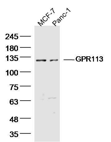 Fig1: Sample:; MCF-7 Cell (Human) Lysate at 40 ug; Panc-1 Cell (Human) Lysate at 40 ug; Primary: Anti- GPR113 at 1/300 dilution; Secondary: IRDye800CW Goat Anti-Rabbit IgG at 1/20000 dilution; Predicted band size: 114 kD; Observed band size: 120 kD
