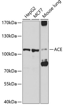 Western blot - ACE Polyclonal Antibody 