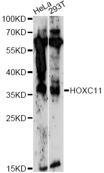 Western blot - HOXC11 Polyclonal Antibody 