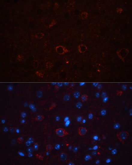 Immunofluorescence - THY1 Polyclonal Antibody 
