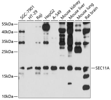 Western blot - SEC11A Polyclonal Antibody 