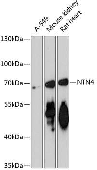 Western blot - NTN4 Polyclonal Antibody 