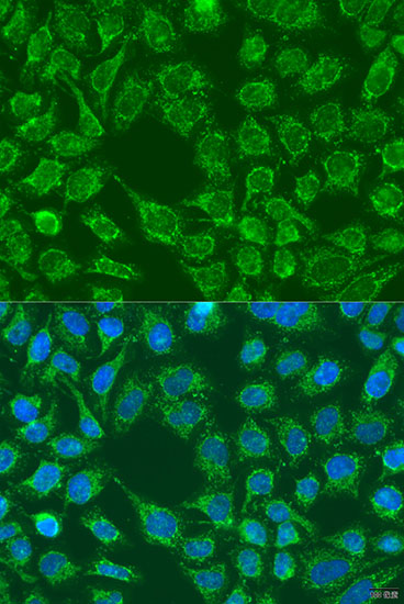 Immunofluorescence - WNT7B Polyclonal Antibody 