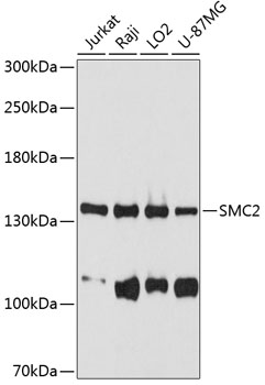 Western blot - SMC2 Polyclonal Antibody 