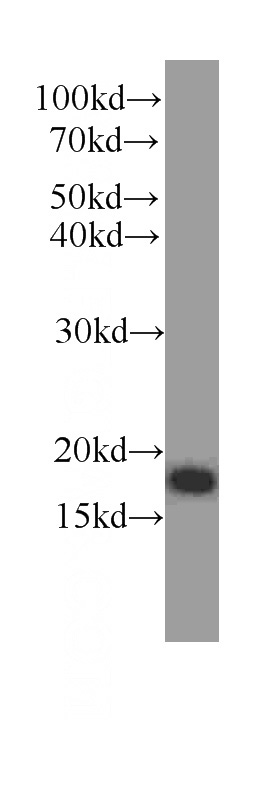 human brain tissue were subjected to SDS PAGE followed by western blot with Catalog No:107327(NENF antibody) at dilution of 1:1000