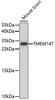 Western blot - TMEM147 Polyclonal Antibody 