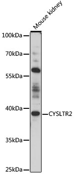 Western blot - CYSLTR2 Polyclonal Antibody 