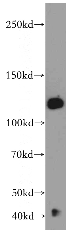 mouse brain tissue were subjected to SDS PAGE followed by western blot with Catalog No:108952(CC2D1B antibody) at dilution of 1:500
