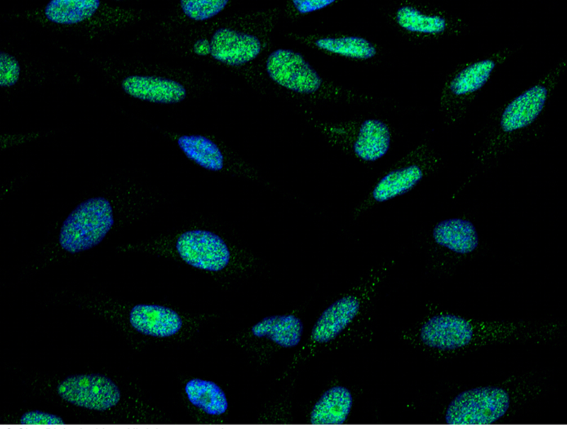 Human TLK1 Immunofluorescence(IF) 14906