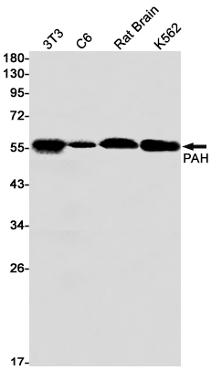Western blot detection of PAH in 3T3,C6,Rat Brain,K562 cell lysates using PAH Rabbit mAb(1:1000 diluted).Predicted band size:52kDa.Observed band size:52kDa.