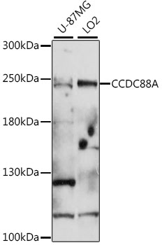Western blot - CCDC88A Polyclonal Antibody 