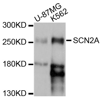 Western blot - SCN2A Polyclonal Antibody 