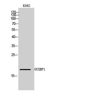 Fig1:; Western Blot analysis of K562 cells using GUSBP1 Polyclonal Antibody
