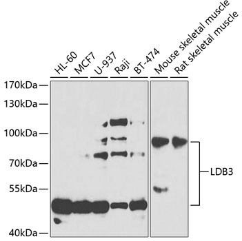 Western blot - LDB3 Polyclonal Antibody 
