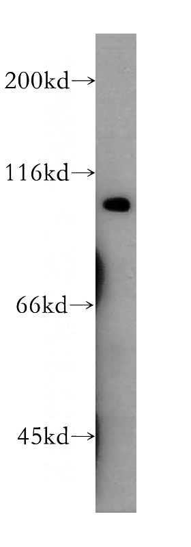 human brain tissue were subjected to SDS PAGE followed by western blot with Catalog No:109110(CDC5L antibody) at dilution of 1:400