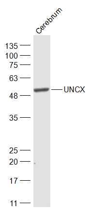 Fig4: Sample:; Cerebrum (Rat) Lysate at 40 ug; Primary: Anti-UNCX at 1/5000 dilution; Secondary: IRDye800CW Goat Anti-Rabbit IgG at 1/20000 dilution; Predicted band size: 54 kD; Observed band size: 54 kD