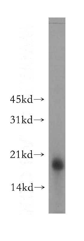 mouse brain tissue were subjected to SDS PAGE followed by western blot with Catalog No:114534(RAMP2 antibody) at dilution of 1:400