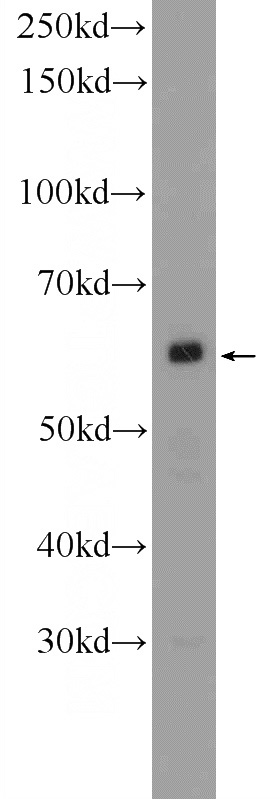 Raji cells were subjected to SDS PAGE followed by western blot with Catalog No:113975(PNLDC1 Antibody) at dilution of 1:600