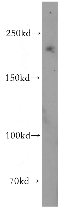 mouse liver tissue were subjected to SDS PAGE followed by western blot with Catalog No:111803(INO80 antibody) at dilution of 1:400