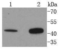Fig1:; Western blot analysis of Angiotensin II Type 2 Receptor on different lysates. Proteins were transferred to a PVDF membrane and blocked with 5% BSA in PBS for 1 hour at room temperature. The primary antibody ( 1/500) was used in 5% BSA at room temperature for 2 hours. Goat Anti-Rabbit IgG - HRP Secondary Antibody (HA1001) at 1:5,000 dilution was used for 1 hour at room temperature.; Positive control:; Lane 1: 293T cell lysate; Lane 2: Hela cell lysate