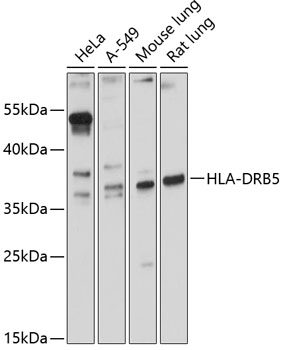 Western blot - HLA-DRB5 Polyclonal Antibody 