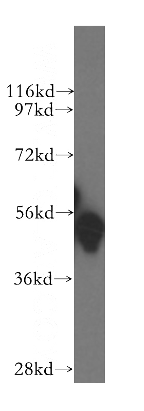 K-562 cells were subjected to SDS PAGE followed by western blot with Catalog No:110878(GATA1 antibody) at dilution of 1:1200
