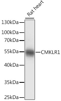 Western blot - CMKLR1 Polyclonal Antibody 